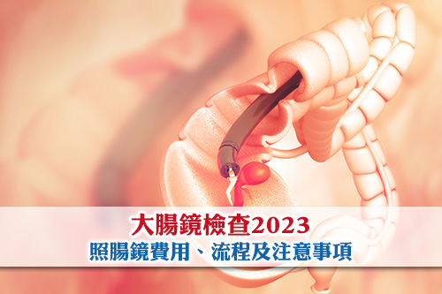 大腸鏡檢查2023-照腸鏡邊間好-大腸鏡檢查費用-大腸鏡檢查流程